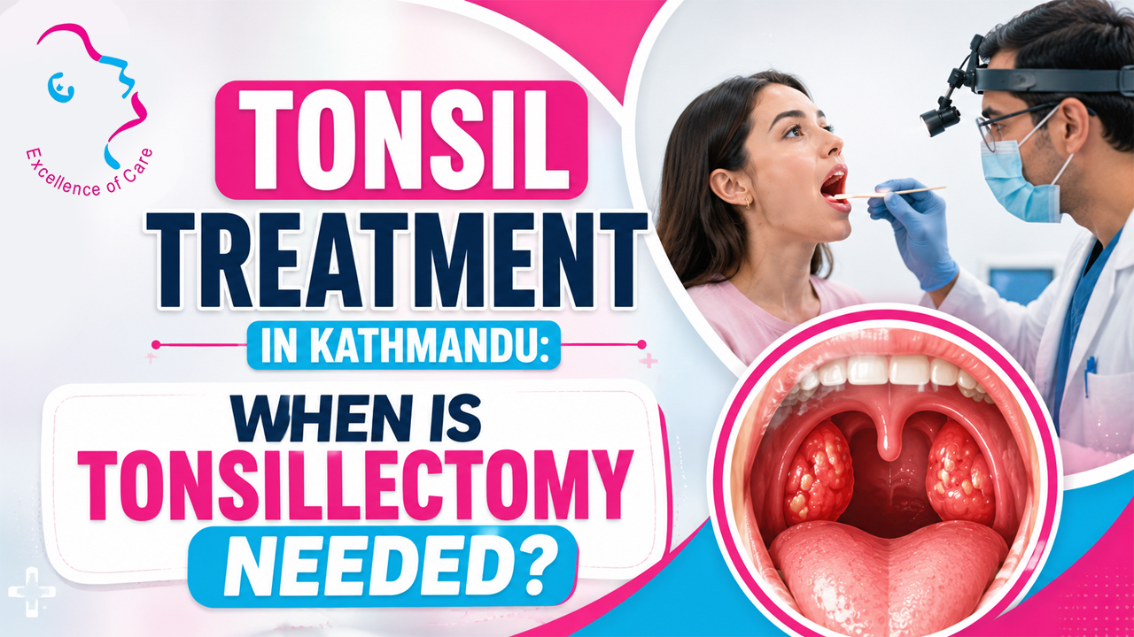 Tonsil Treatment in Kathmandu: When Is Tonsillectomy Needed?